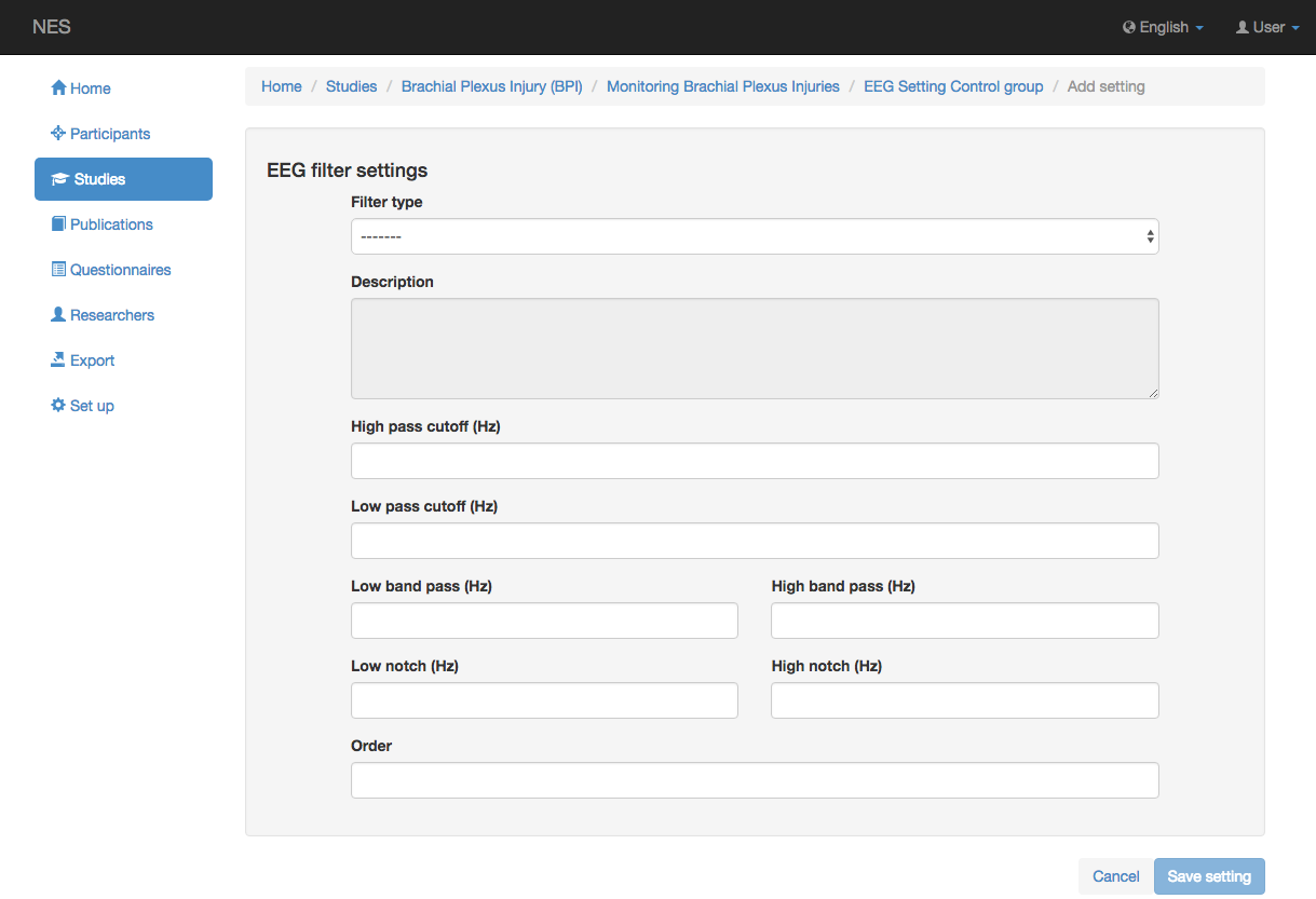 ../../../_images/eeg_filter_settings.png