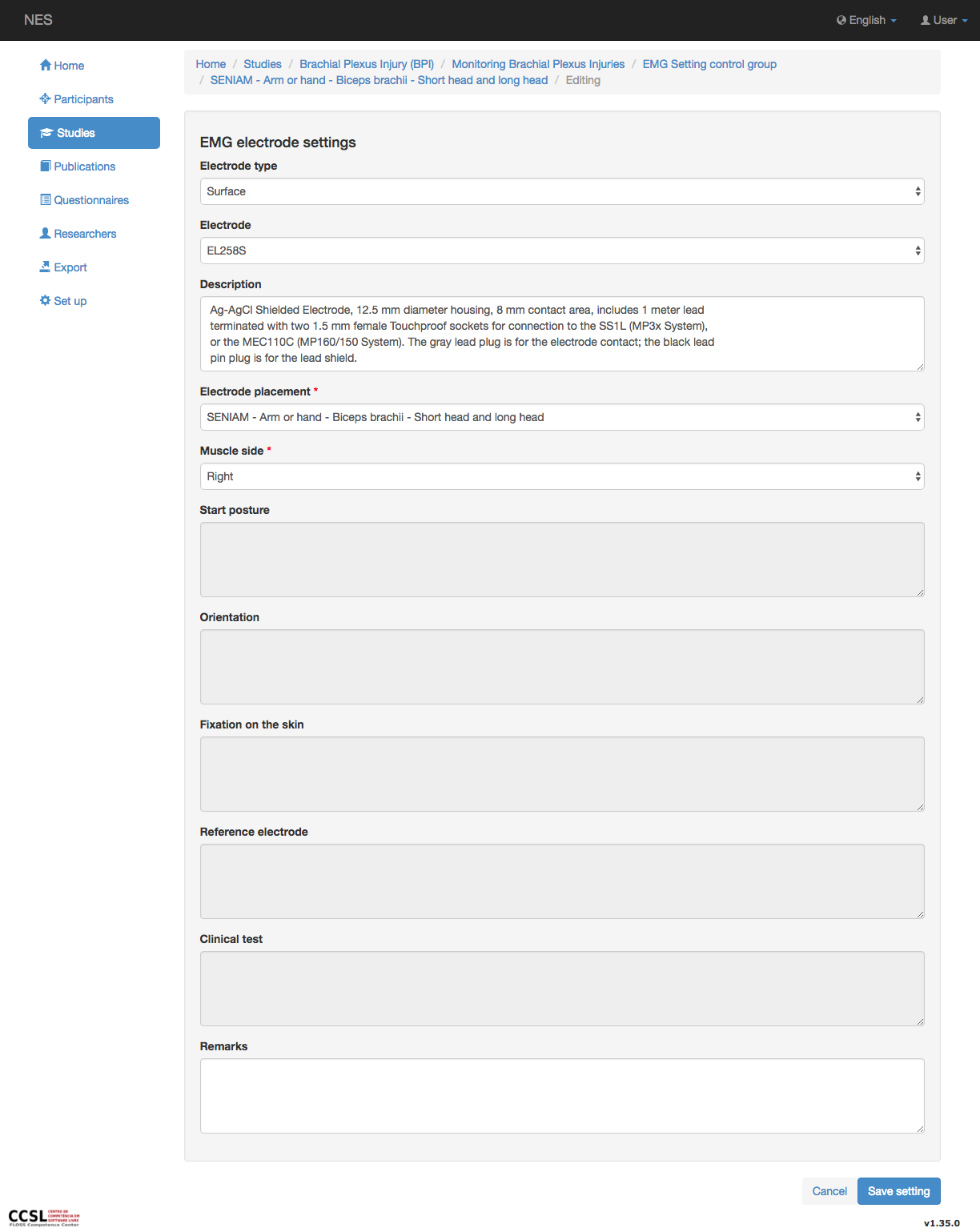 ../../../_images/emg_setting_electrode_settings_view_1.png